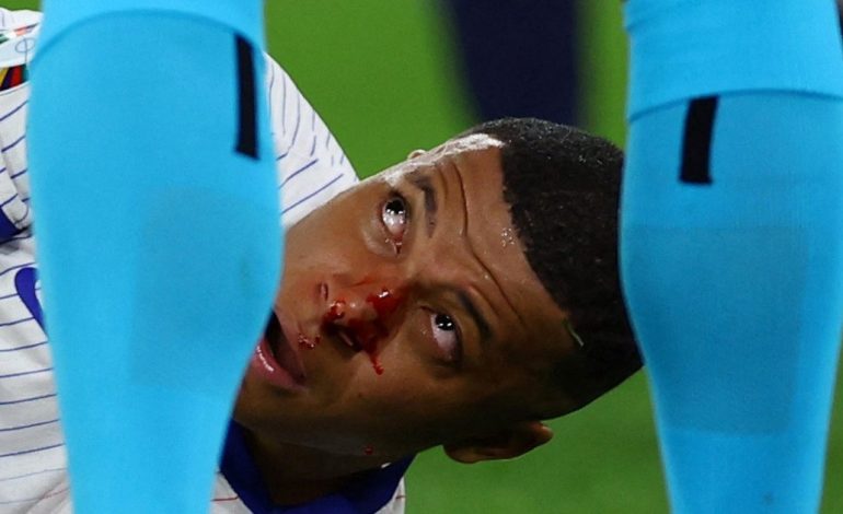 francia-gano-en-su-debut-en-la-eurocopa-pero-hay-maxima-preocupacion-por-mbappe-y-aseguran-que-debe-ser-operado