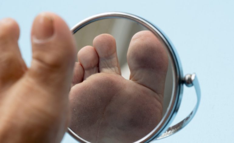 diabetes:-las-senales-de-alarma-que-hay-que-buscar-en-los-pies-para-evitar-amputaciones