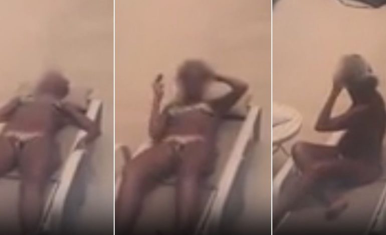 tomaba-sol-al-lado-de-la-pileta-en-rio-de-janeiro-y-una-bala-perdida-le-pego-en-la-cabeza:-se-salvo-de-milagro